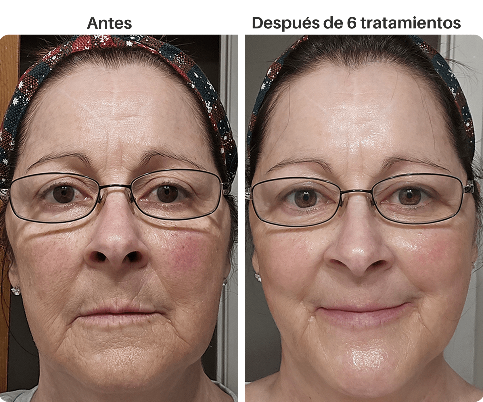 SKIN BOOST + INFUSIÓN - Avella
