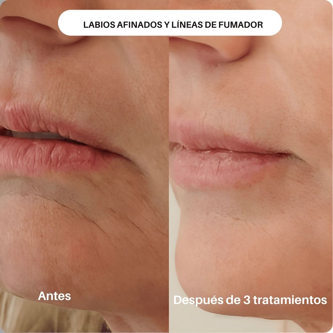 SKIN BOOST + INFUSIÓN - Avella