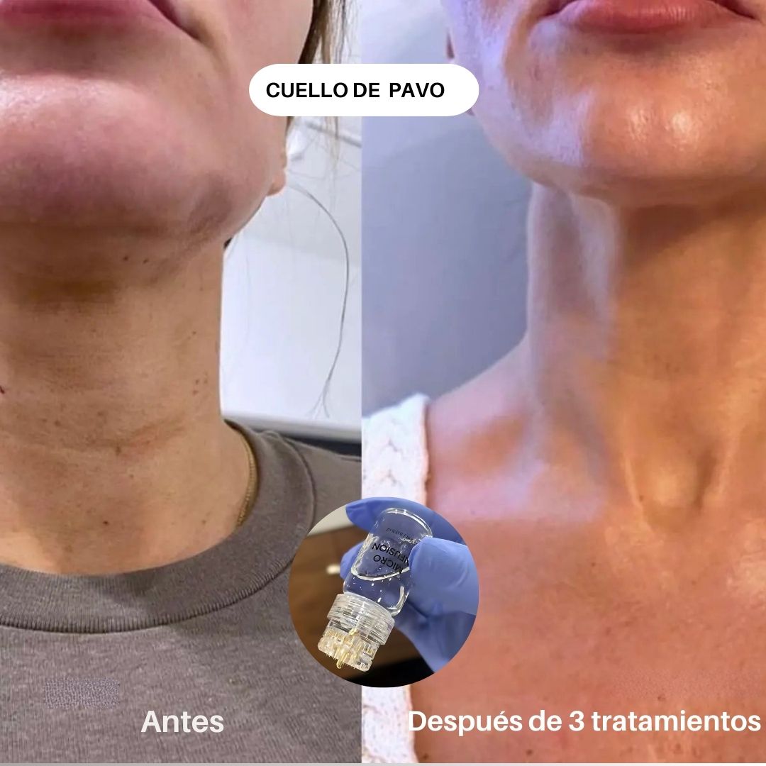 SKIN BOOST+ INFUSIÓN - Avella