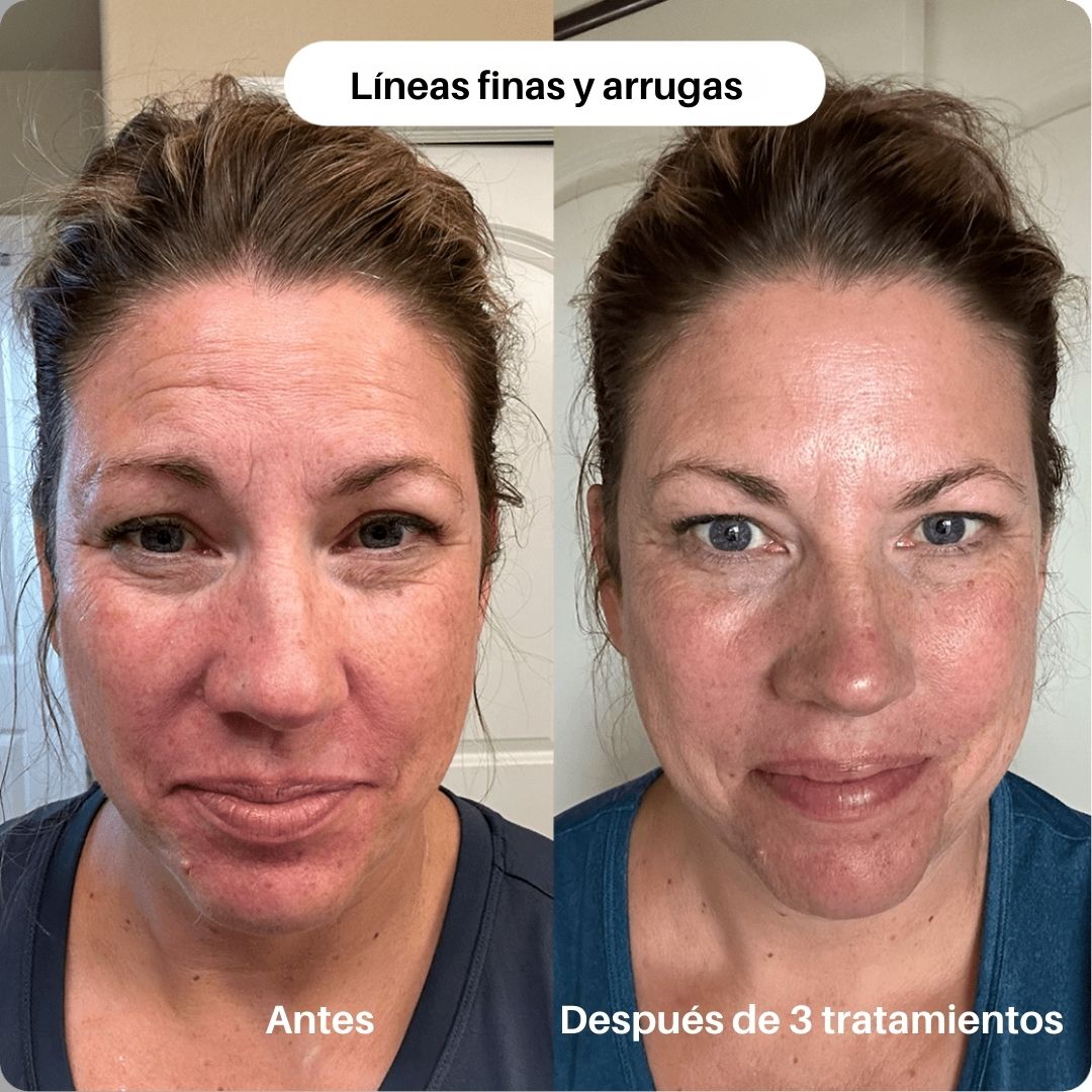 SKIN BOOST+ INFUSIÓN - Avella