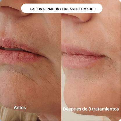 SKIN BOOST + INFUSIÓN - Avella