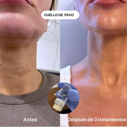 SKIN BOOST+ INFUSIÓN - Avella